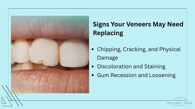 Reasons Veneers Require Replacement