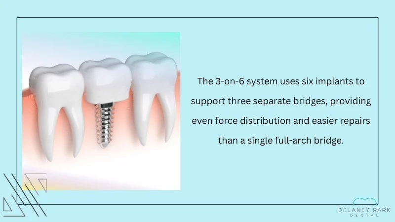 Bridge Design and Implant Distribution