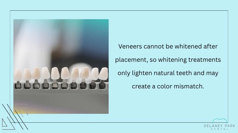 Can You Whiten Veneers After Placement
