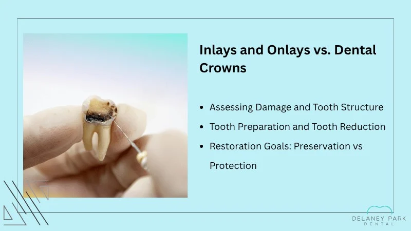 inlays-and-onlays-vs-dental-crowns