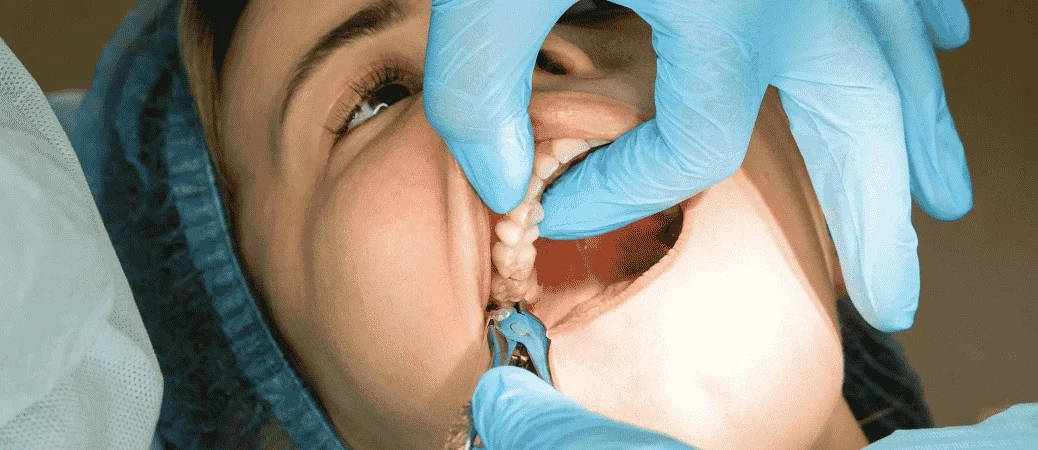 wisdom teeth removal adults